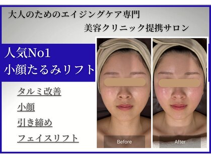 シューラディアント 東京浜松町店(ShuRadiant)の写真