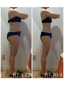 ルミナ ビューティーアンドリラックス(LUMINA Beauty&Relax)の写真/年齢を重ねて落ちなくなった二の腕ハミ肉をプロにお任せ！熟練スタッフの技術×高機能マシンで美ボディへ♪