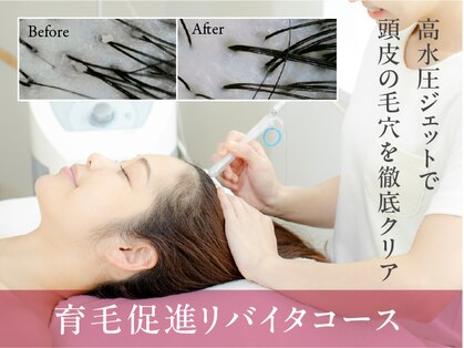 女性のための育毛促進・頭皮ケア専門サロン イーズ/リバイタ ららぽーと横浜の写真