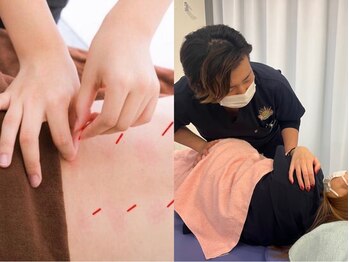 松戸駅前鍼灸院 整骨院の写真/女性の慢性的なお悩みを根本改善！O脚改善・産後骨盤矯正・花粉による不調をケア★女性限定50％OFF！！