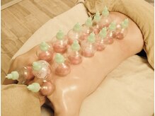 アコルデ(Acorde)の雰囲気(カッピング(吸い玉)で中々の取れないコリやむくみケア♪)