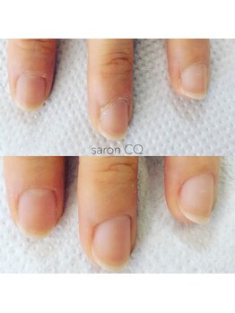 トータルビューティCQ/甘皮処理