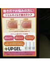 巻き爪　ケア　ジェル
