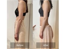 サロンツキ(salon tuki)/【バストケア】症例★