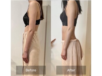 サロンツキ(salon tuki)/【バストケア】症例★