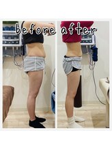 昭和区川名ひまわり接骨院/産後骨盤矯正×ダイエット【7】