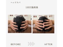サロンエイトミー 西船橋店(salon 83)/【ヘッドスパ】1回before→after