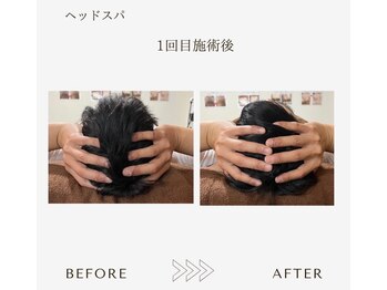 サロンエイトミー 西船橋店(salon 83)/【ヘッドスパ】1回before→after