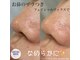 ベリンダ ワックス(BELINDA WAX)の写真