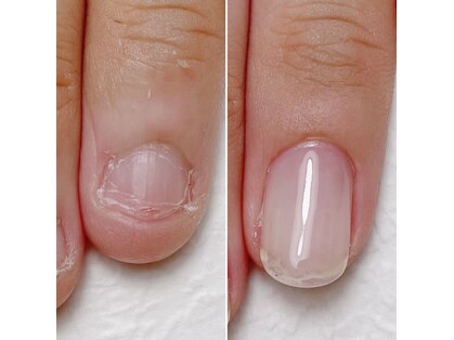 ネイルサロン アイリー(Nail salon Irie)の写真