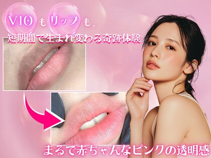 ビアル(VIALU)の写真