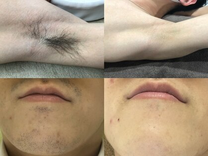 アルシスタ(ARCISTA)の写真