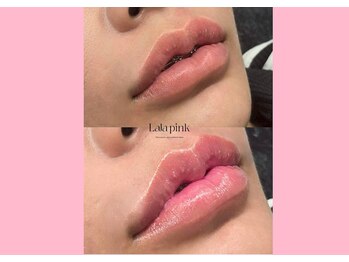 ハーシークレット(Her secret)/ララピンク・メラニンケア