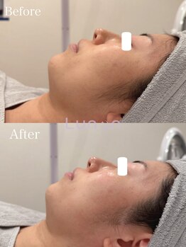 ルノン(Lunon)/ララピール