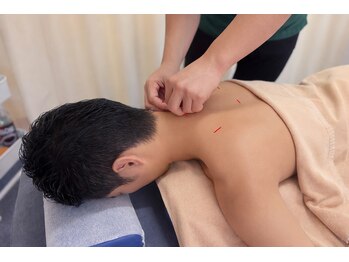 あき鍼灸整骨院/鍼灸施術