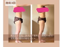 ヨサパーク リナータ(YOSA PARK Rinata)/3回で劇的変化！温流で叶う美脚