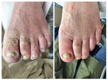 フレッシュフット(FreshFoot)/足のトラブルお任せください