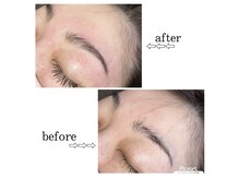 ベリーナ(Bellina)/