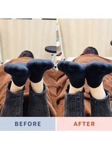 ナオル整体 三鷹院(NAORU整体)/20代女性施術事例【足の長さ】