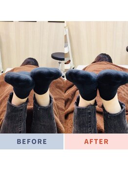 ナオル整体 三鷹院(NAORU整体)/20代女性施術事例【足の長さ】