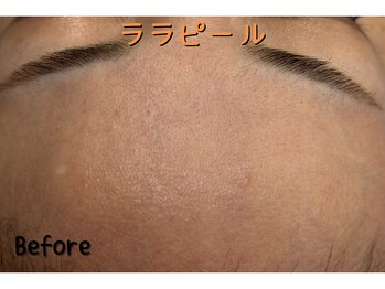 ダイヤモンド リーエンダ(Diamond leende)/ララピール