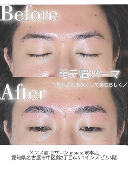 モテテ(motete)/お客様施術例☆栄本店