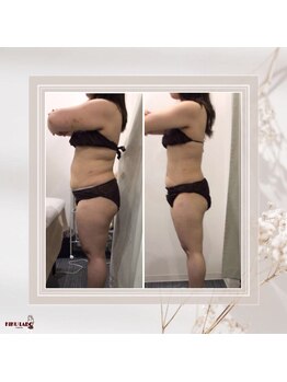 効くラボ 梅田店/3ヶ月で理想のボディに！