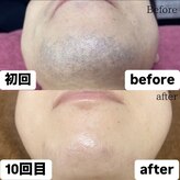 クロズキン 赤坂店(Kurozukin)