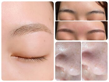 トータルビューティ ノイド(Noid)/小鼻コース+美眉毛WAX脱毛