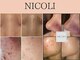 ニコリ(NICOLI)の写真