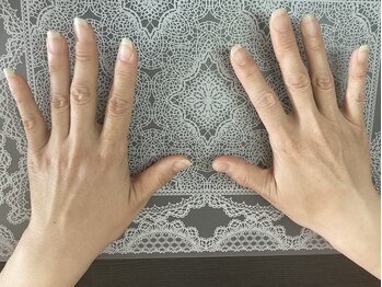 桃の木 吉祥寺店/40代女性before