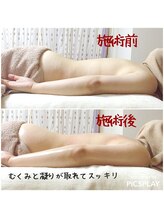 スーク(souk luxe)/肩こり・むくみ解消コース