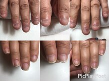 サロン ルーシュ(salon ruche)/育成ネイル