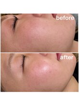 リベル ビー(ReBell Bee)/フルフェイスワックス