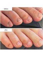 ケアプラス(care plus)/フットネイルケア