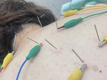 もみの木鍼灸整骨院 恵比寿/自律神経の回復と疲労の改善