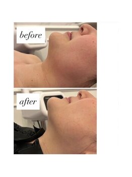 ココ センガ ビューティー クリニック(COCO SENGA Beauty-Clinic)/徹底脂肪撃退！