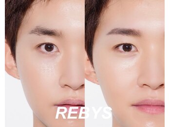 レバイス(REBYS)