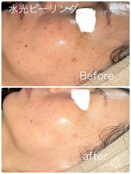 ルミネル 名古屋新栄(Luminelle)/ビフォーアフター