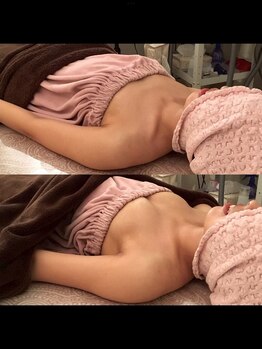 ヴィーナス(Venus)/バストケア