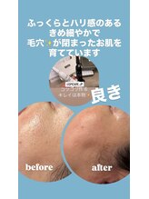 ジュネラ ボーテ(Jenela beaute)/ツヤハリ変化