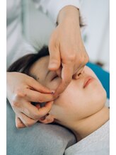 大田鍼灸/内出血しない美容鍼