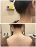 【プロの技で輝く素肌へ】えり足&フェイスシェービングでワントーン明るく♪
