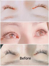 ルイーゼ(Luise)/フラットラッシュ