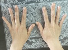 桃の木 吉祥寺店/40代女性after