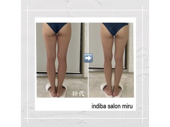 ミル(miru)/インディバ全身120分で美脚1回