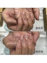 ネイルサロン フィオーレ/ネイルケア