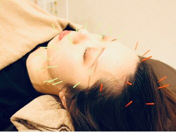 クマノミ美容鍼灸 川越院(KUMANOMI美容鍼灸)/リフトUP!ブルドック顔解消!