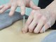 アロハ整骨院はりきゅう院の写真/身体のつぼや経路を刺激◎鍼灸施術で痛みの原因に直接アプローチし、身体の不調を根本改善!桜台駅徒歩3分!