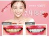 【7月限定】セルフホワイトニング(9分2セット)1回¥3,980→¥500